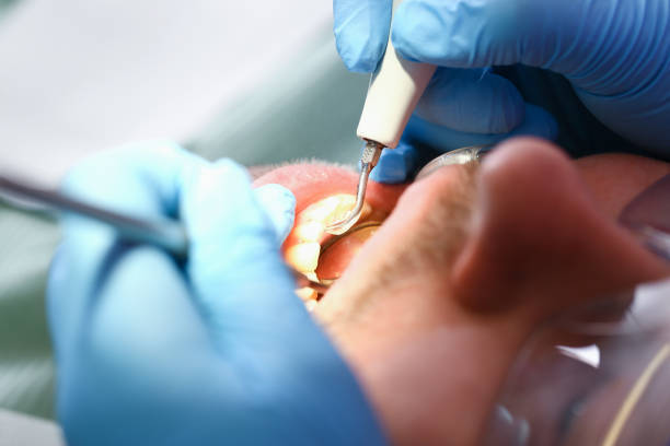 Best Weekend Emergency Dentist in Black Hammock, FL