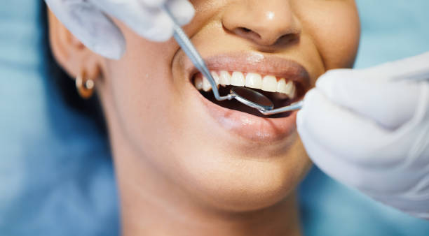 Best Emergency Wisdom Teeth Removal in Black Hammock, FL